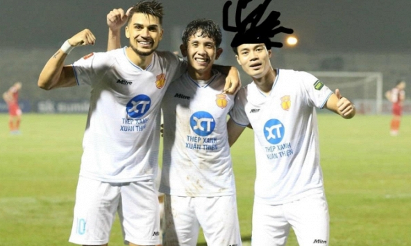 'Chủ tịch' Văn Toàn khoe mái móc tới cực hài hước, tự nhận 'ít tóc nhưng giàu' 