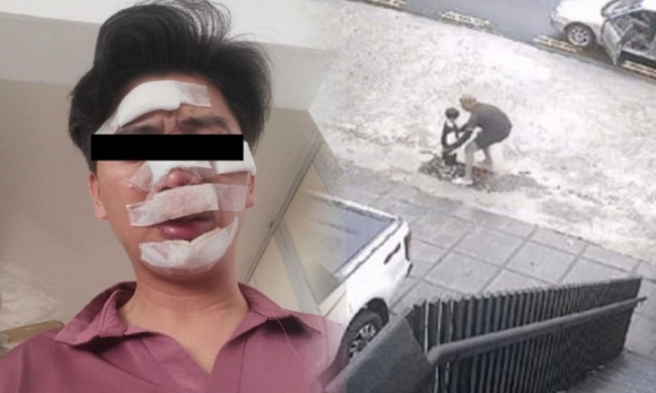 Con trai bị bắt cóc đòi tiền chuộc 1,5 tỷ VNĐ, bố bị thương khắp mặt vì liều mạng giành lại con và câu chuyện khó hiểu phía sau