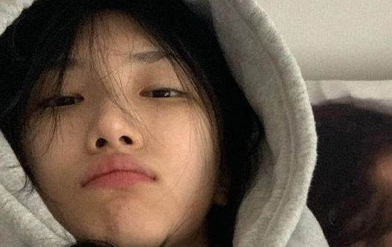 “3 tăng, 2 giảm 1 mềm” cảnh báo cơn nhồi máu não đang ập tới, coi chừng mất mạng