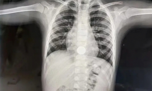 'Con kể mẹ nghe 1 bí mật' - Bà mẹ toát mồ hôi sau lời nói của đứa trẻ 3 tuổi, vội đưa con đi cấp cứu ngay trong đêm