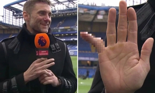 Sau khi chơi gần 700 trận, cựu thủ môn gây ngỡ ngàng khi tiết lộ hình ảnh ngón tay út