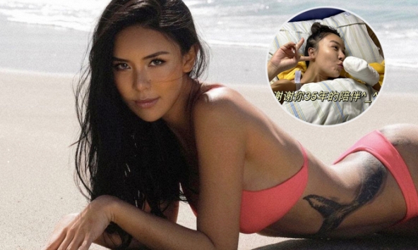 Nữ người mẫu gặp tai nạn thảm khốc mất đi bàn tay trái và bài đăng đầu tiên khiến hàng nghìn netizen cảm phục