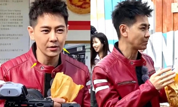 Xót xa hình ảnh Lâm Chí Dĩnh lộ khuôn mặt lồi lõm sau tai nạn xe nghiêm trọng