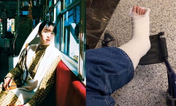 Dành 270 triệu mua bảo hiểm sau 1 lần gãy chân, cô gái 29 tuổi chỉ ra 2 điều cần đặc biệt lưu tâm