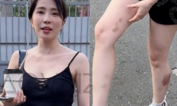 Quỳnh Nga lộ chân tay bầm tím khi vừa được 'hồi sinh' tại Đạp gió, Lệ Quyên liền trao luôn danh hiệu