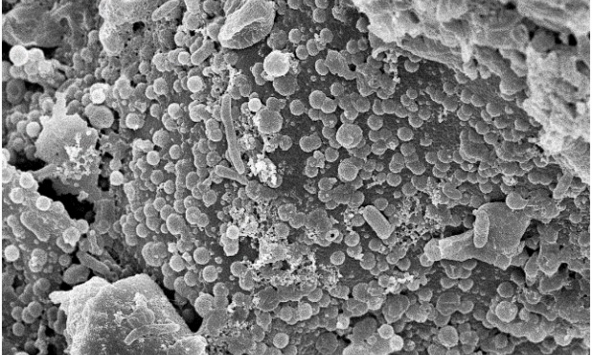 TS. Lê Thị Nhi Công nghiên cứu 'Chế phẩm xử lý ô nhiễm dầu bằng vi khuẩn tạo màng sinh học trên than sinh học có nguồn gốc từ trấu'