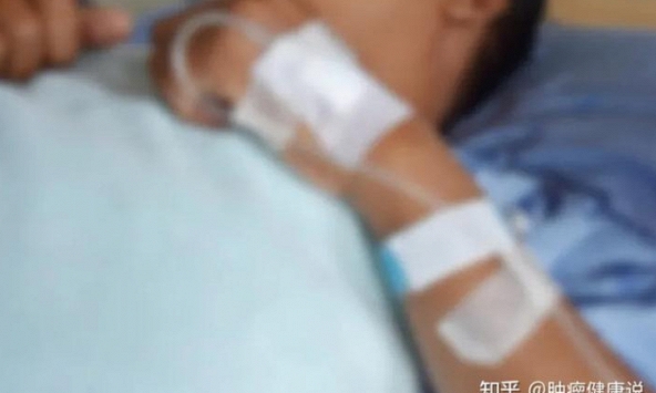 24 tuổi đã bị ung thư ruột nhắm tới chỉ bởi một thức uống 'vui miệng', bác sĩ cảnh báo thói xấu nhiều người hay mắc