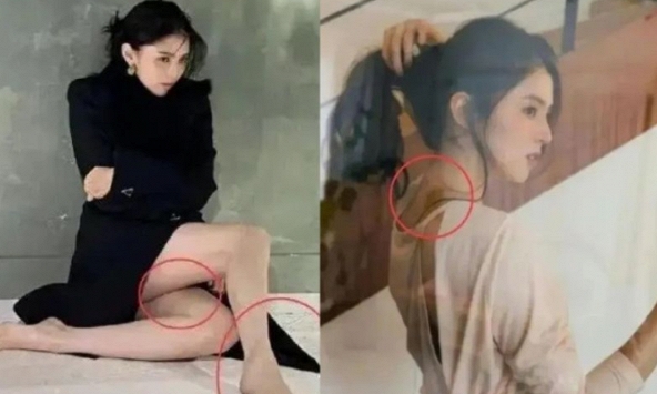 Truyền thông Hoa ngữ đặt nghi vấn Han So Hee bị bạo hành do xuất hiện nhiều vết bầm tím trên cơ thể