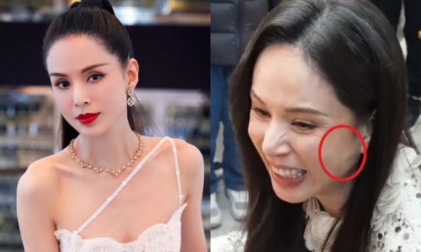 'Tiểu Long Nữ' Lý Nhược Đồng bị nghi vấn 'dao kéo' vì 1 chi tiết lạ trên mặt, nhưng sự thật lại đáng xót xa