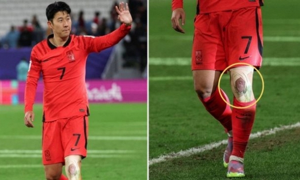 Xót xa trước hình ảnh Son Heung-min gắng gượng thi đấu với cái đầu gối bị quấn băng chằng chịt