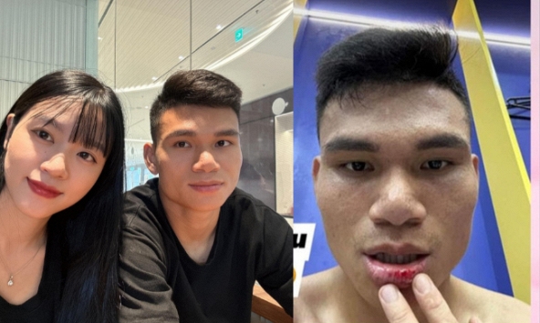 Hậu vệ từng 'nghèo nhất Việt Nam' chảy máu môi khi thi đấu, vợ không thương lại nói lời 'cay đắng' thế này đây