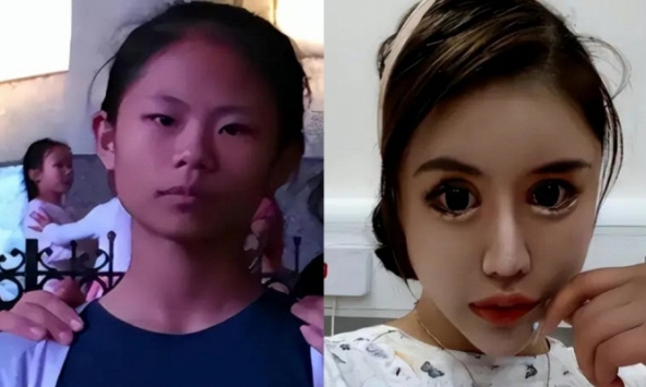 Cô gái nghiện làm đẹp từ năm 13 tuổi, chi 14 tỷ đồng để phẫu thuật thẩm mỹ, hiện tại hối hận nhưng đã muộn màng