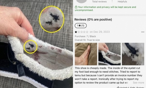 Mua giày giá rẻ trên sàn thương mại điện tử nổi tiếng, người phụ nữ mất 50 triệu VNĐ điều trị vết thương còn mang sẹo ám ảnh cả đời