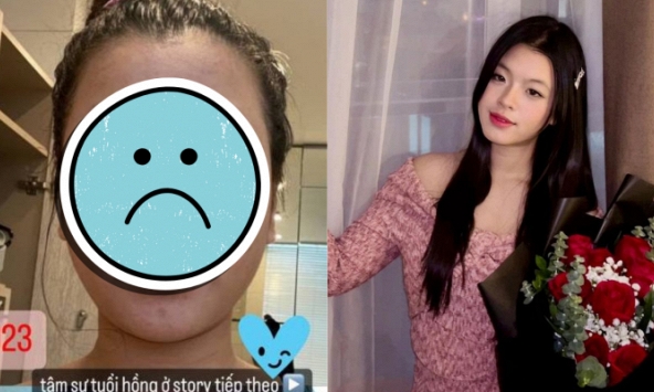 Tiểu thư nhà NSƯT Chiều Xuân tâm sự về khủng hoảng tăng 8kg và da nổi chi chít mụn, nói 1 điều Gen Z nào cũng thấy đồng cảm!