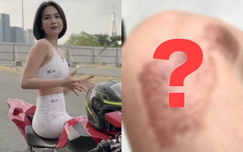 Ngọc Trinh zoom cận tình trạng những vết thương sau 4 tháng gặp tai nạn lái xe mô tô