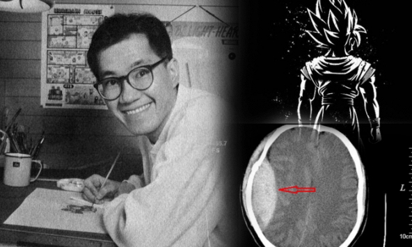Tổn thương gì ở não khiến tác giả '7 viên ngọc rồng' qua đời ở tuổi 68?