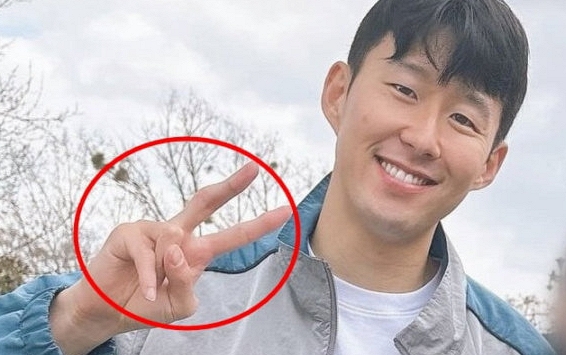 Xót xa hình ảnh ngón tay bị biến dạng của Son Heung-min sau hơn 1 tháng từ vụ ẩu đả với Lee Kang-in