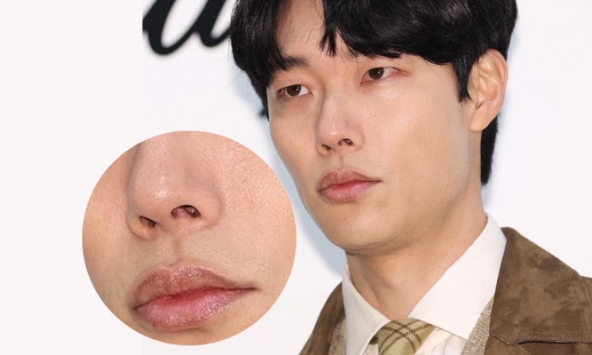 Gỉ mũi gây khó chịu và 'mất thẩm mỹ', lấy sao cho đúng?