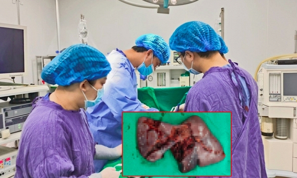 Hà Nội: Bị tai nạn giao thông xong về nhà ngủ, thanh niên 19 tuổi suýt mất mạng vì điều này