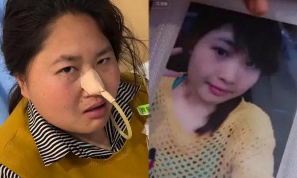 5 năm làm mukbang, ngoại hình cô gái 33 tuổi thay đổi chóng mặt khiến dân mạng cứ ngỡ bà dì trung niên: 'Dùng thân xác đổi tiền bạc'