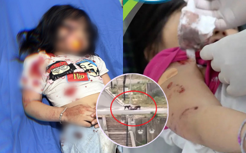 Những vụ chó thả rông cắn người trọng thương trên đường phố gây bức xúc: Chủ vật nuôi có phải chịu trách nhiệm?