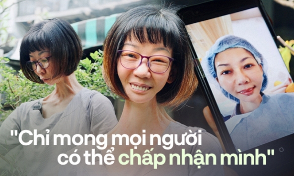 Bị mọi người xa lánh vì ngoại hình, người phụ nữ ở TP.HCM rớt nước mắt nói về khao khát hòa nhập cộng đồng