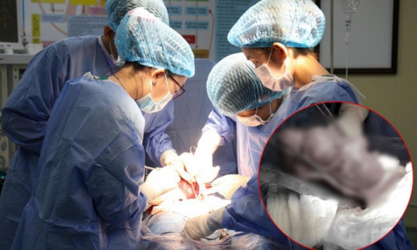 Người phụ nữ ở Bạc Liêu bỗng đau bụng dữ dội, phẫu thuật lấy ra được một thứ nặng đến 900 gram