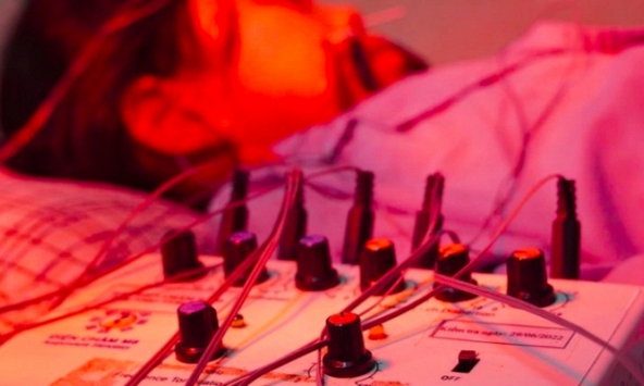 Bé gái 8 tuổi ở Phú Thọ bị liệt mặt ngoại biên, bác sĩ cảnh báo: Tuyệt đối không mở điều hòa quá lạnh vào mùa hè!