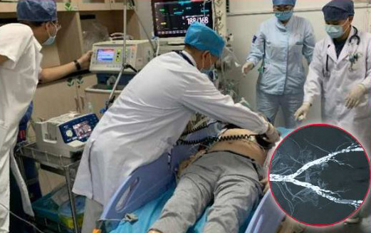 Người đàn ông có mạch máu vôi hóa như ruột bút chì, qua đời vì mê 1 thực phẩm