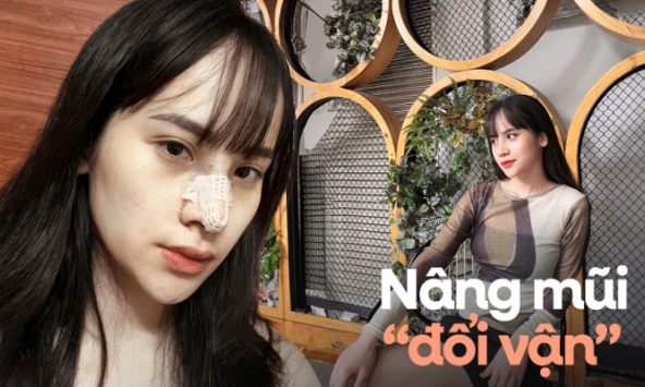 Hành trình nâng mũi 'đổi vận' của cô gái 9x: Được cả gia đình 'tháp tùng' đi thẩm mỹ và nhan sắc thay đổi bất ngờ