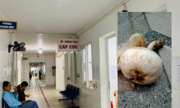 Bé 7 tuổi ở Cao Bằng ngộ độc vì ăn một thứ hái ngay trong vườn