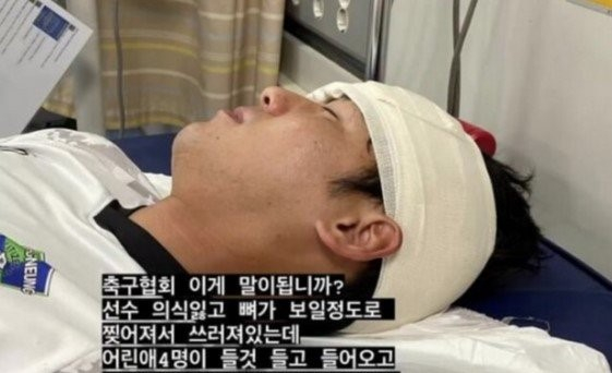 Dùng xe tải chở cầu thủ bị rách trán, lộ xương đi bệnh viện thay vì xe cứu thương, Hiệp hội bóng đá Hàn Quốc bị chỉ trích