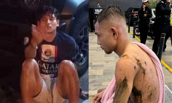 Hai ngôi sao đội tuyển Malaysia bị tạt axit và bị chém có nguy cơ nghỉ hết vòng loại World Cup 2026 