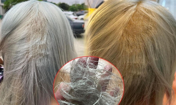 Kiếp nạn khi tẩy tóc: Làm hết 8.5 triệu, vẫn phải mua thêm bộ tóc giả về đội vì tóc rụng gần hết