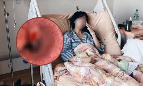 Cô gái Kiên Giang 26 tuổi từ vong chỉ sau 12 giờ phát hiện ung thư dạ dày, đâu là những biểu hiện sớm?