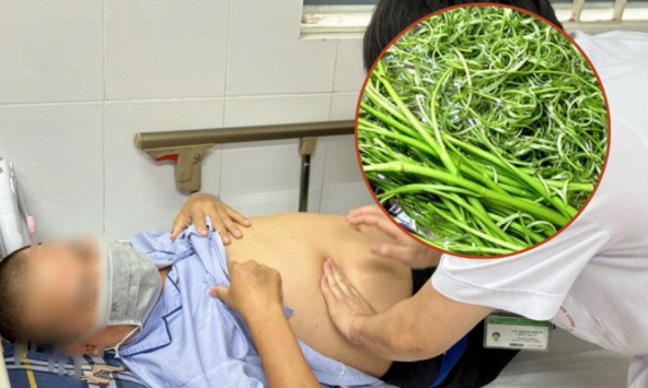 Người đàn ông Phú Yên phát hiện cả 'ổ' sán lá gan trong người vì 'nghiện' một món quen thuộc với dân Việt