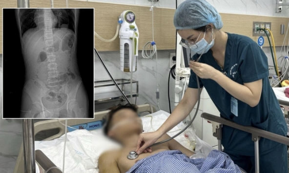 5 giờ phẫu thuật cho thiếu niên 15 tuổi bị cành cây đâm xuyên vùng hậu môn khi nhảy xuống ao tắm