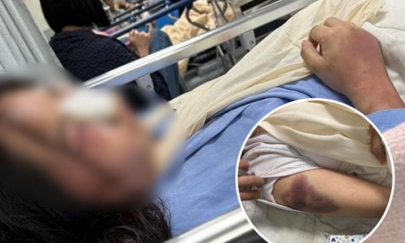 MXH dậy sóng câu chuyện cô gái quê Nghệ An bị bạn trai đánh nhập viện vì tô son đi ăn với hội chị em công ty