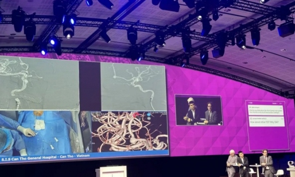 Từ Cần Thơ, bác sĩ Việt Nam 'livestream' can thiệp mạch máu não đến hội nghị quốc tế 