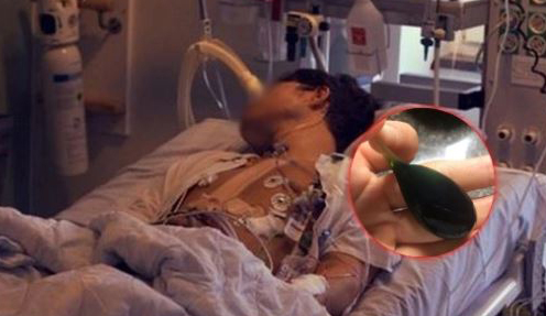 Chàng trai suy đa tạng, rối loạn đông máu nguy kịch vì ăn 1 thứ trong cá độc hơn thạch tín nhưng nhiều người tưởng bổ