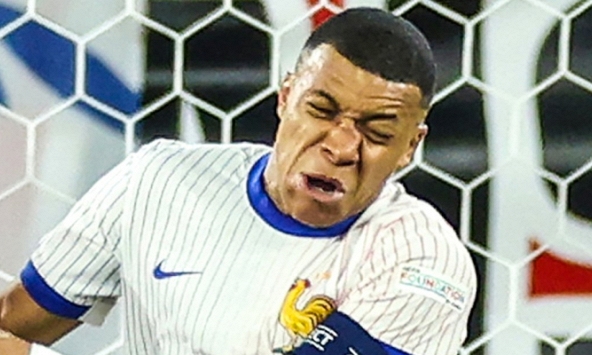 Siêu tiền đạo tuyển Pháp lần đầu lên tiếng sau chấn thương gãy mũi kinh hoàng, hàng triệu fan sôi sục