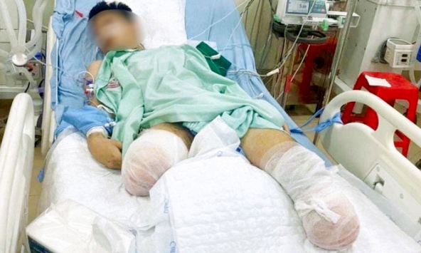 Xót xa gia cảnh của nam sinh bị tai nạn tàu hỏa phải cắt bỏ đôi chân trước kỳ thi tốt nghiệp THPT