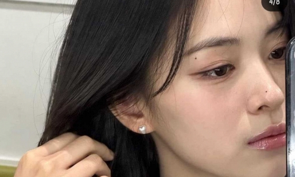 3 đặc điểm của sống mũi cảnh báo sức khỏe, thoái hóa đốt sống, rối loạn nội tiết nằm trong số đó