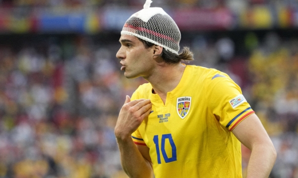 Vì sao cầu thủ Euro 2024 đội chiếc mũ đặc biệt trông như củ hành tây?