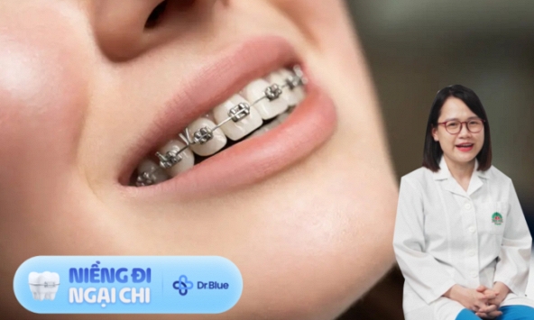 Niềng răng giúp giảm cân, liệu '1 mũi tên có trúng 2 đích'?