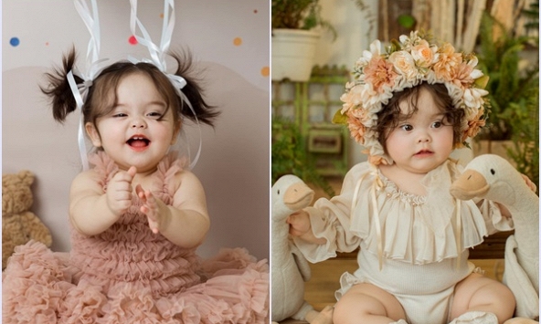 Từng mắc hội chứng lạ khi mới sinh, bé gái 1 tuổi ngày càng nổi tiếng trên MXH nhờ khuôn mặt đáng yêu như thiên thần