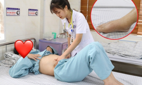 Phú Thọ: Người đàn ông phù nề toàn thân vì uống loại nước nhiều người tưởng 'chỉ có lợi'