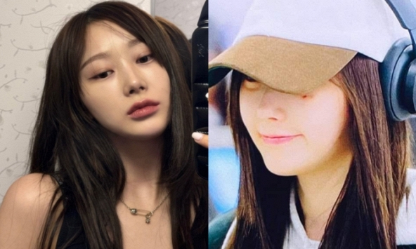 Nữ ca sĩ lộ vết thương nghiêm trọng ngay trên mặt, bị công ty “ghẻ lạnh' suốt thời gian dài?