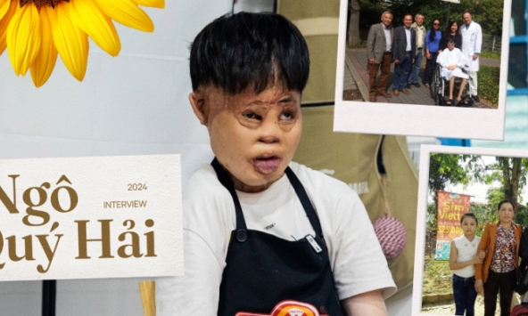 Gặp lại cậu bé ngã vào nồi nước sôi lúc 6 tháng trở thành anh chủ tiệm bánh ở Sài Gòn: “Ngoài kia ai cũng khổ, đâu chỉ riêng mình'