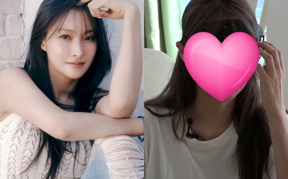 Nữ ca sĩ xinh đẹp công khai diện mạo sau ca phẫu thuật gãy xương hốc mắt và gò má